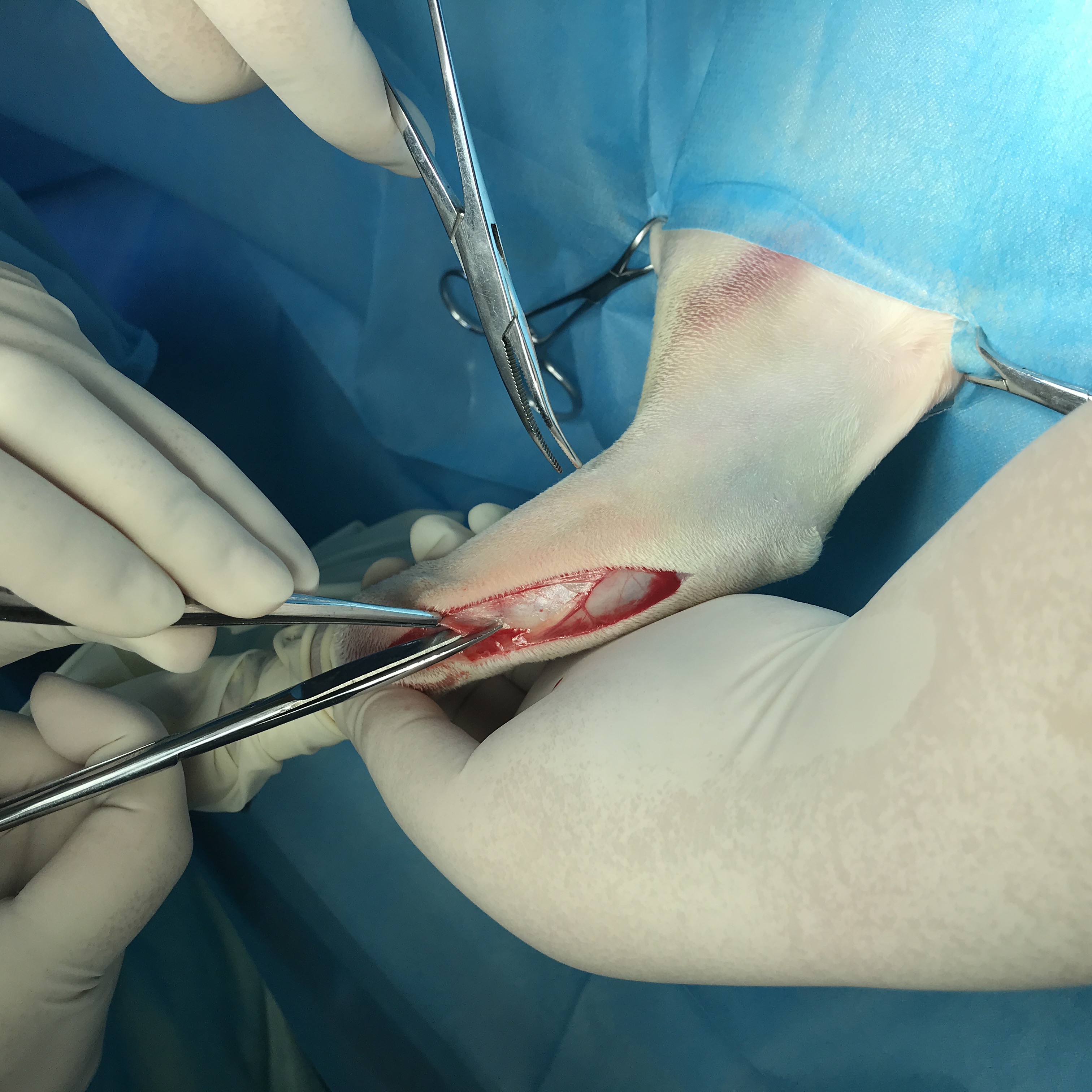 Surgical process